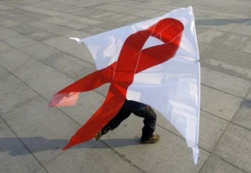 Haber | HIV’in hücre dışına salınımını durduran protein bulundu
