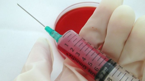 Haber | ABD: Eşcinsel erkeklerin kan bağışlamasına izin verilmeli