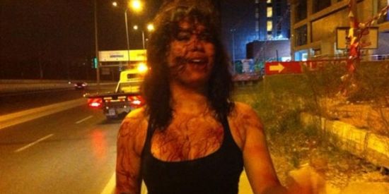 Haber | İstanbul Beylikdüzü`nde trans kadına saldırı