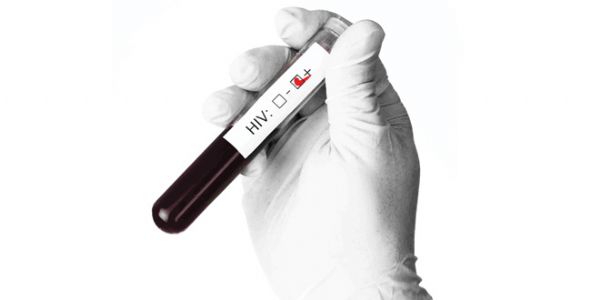 Haber | HIV �LE M�CADELE M�MK�N, TANI ALDIRMAK VE HASTAYA ULA�MAK ZOR