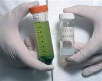Haber | AIDS`in bulaşmasını önleyen aşı